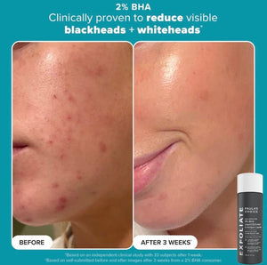Paula’s Choice Smooth&Glow 2 Full Size Exfoliating Toners | Maliha Beauty