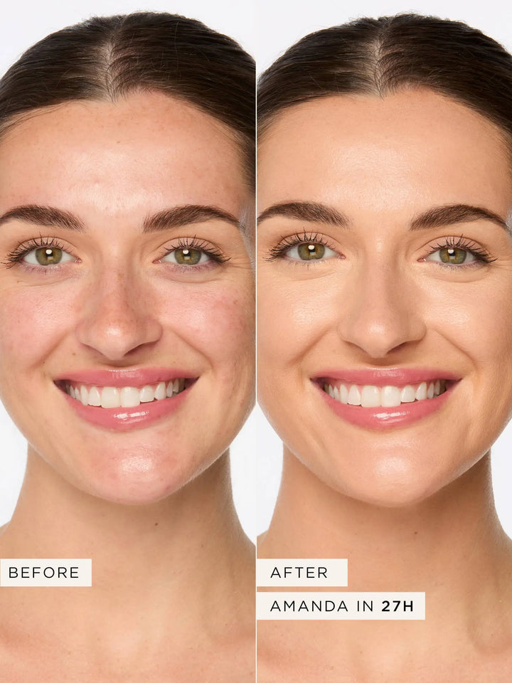 Tarte Shape Tape Contour Concealer Maliha Beauty