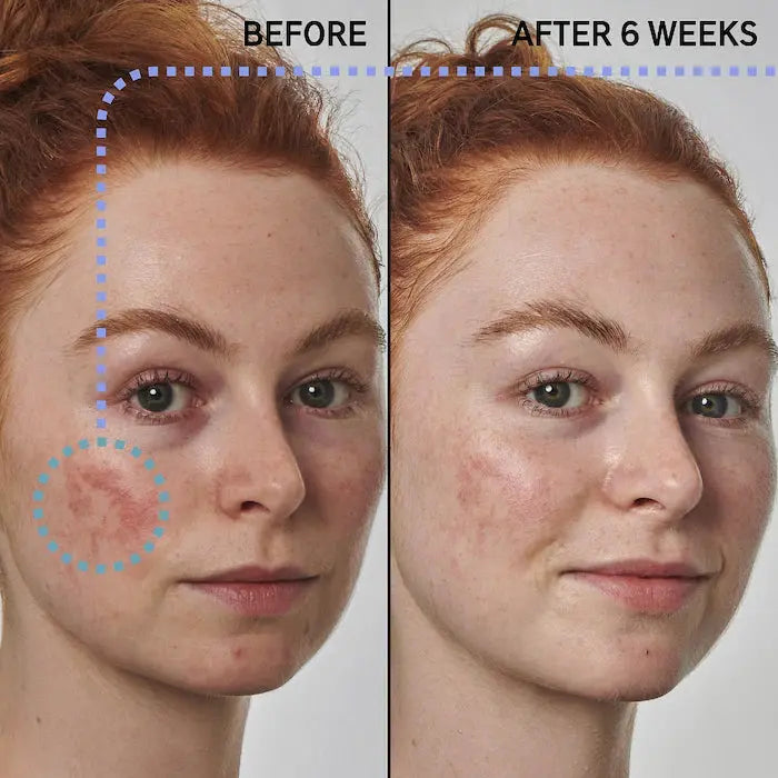 The Inkey List – 10% Azelaic Acid Serum|30ML Maliha Beauty