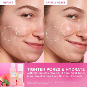 Glow Recipe Watermelon Glow Set | Maliha Beauty