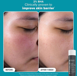 Paula’s Choice Smooth&Glow 2 Full Size Exfoliating Toners | Maliha Beauty